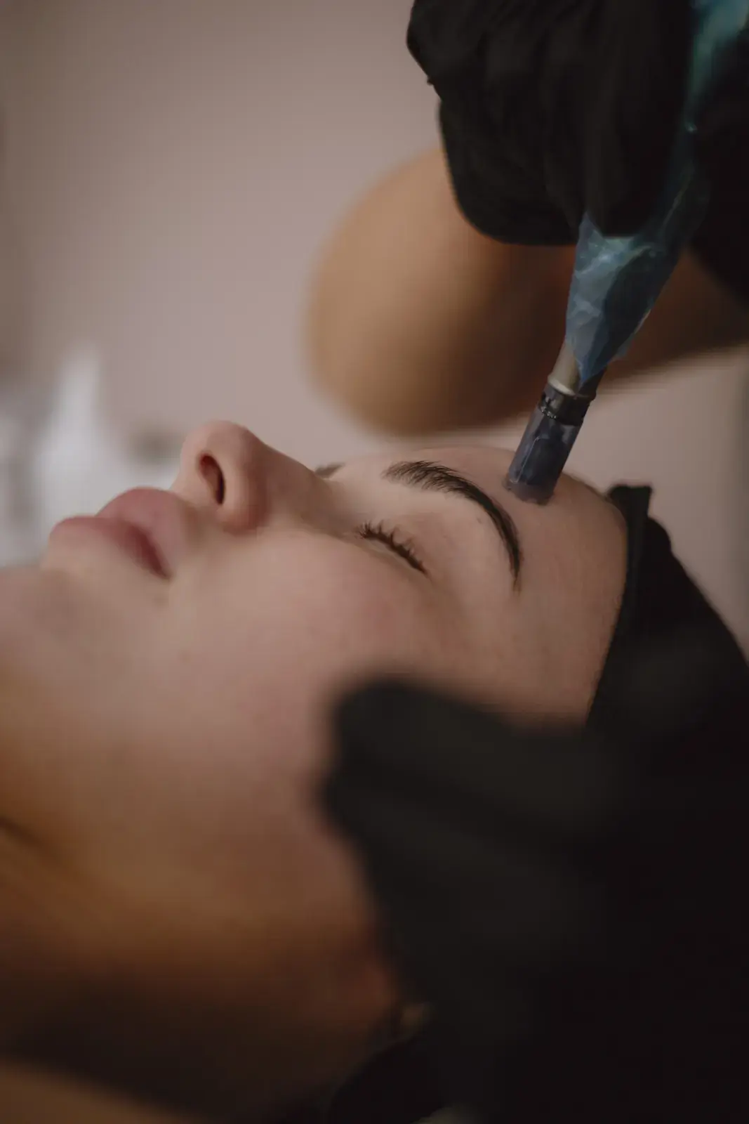 A precise skin-pen facial treatment